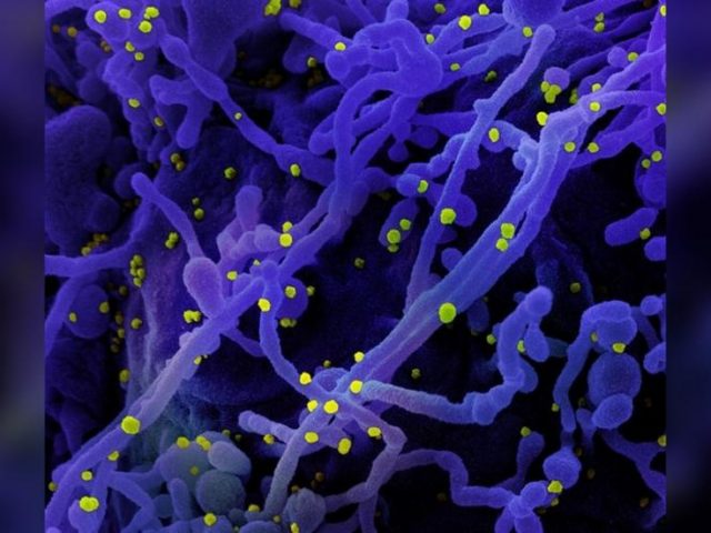 Coronavirus makes infected cells sprout ‘sinister’ tentacles to quickly travel inside the body, new study claims