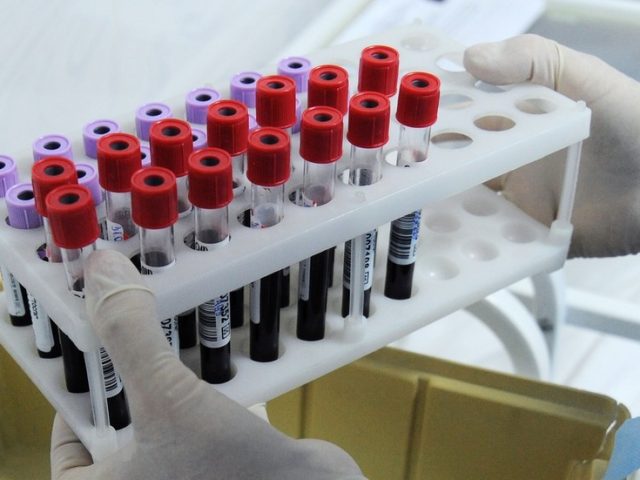Result in just minutes: Russian scientists discover way to diagnose cancer and other diseases with a SINGLE DROP of blood