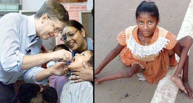 47,000 children crippled and permanently disabled in India, a direct result of Bill Gates’ Polio vaccine